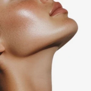 Tratamiento de eliminación de papada